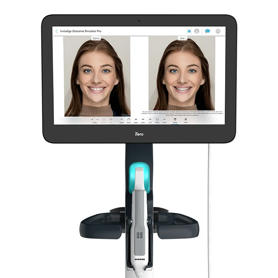 Invisalign Outcome Simulator Pro